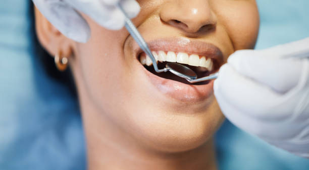 Best Emergency Root Canal Treatment in Lake Station, IN